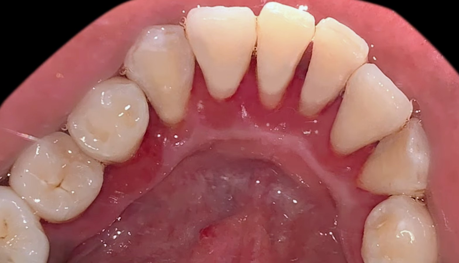 Hygiene & Stain Removal — after