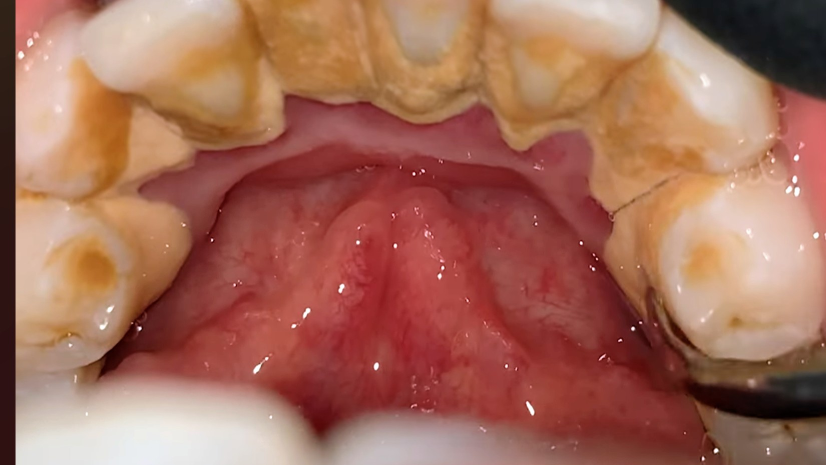 Hygiene & Stain Removal — before
