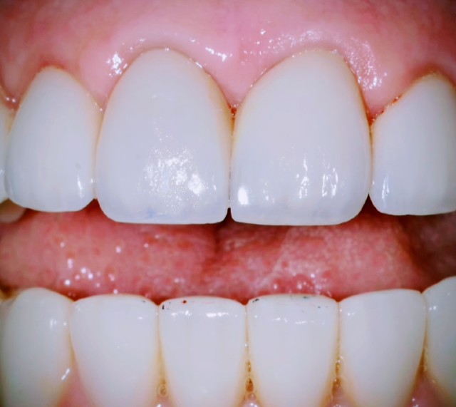 Cosmetic Refinement — after