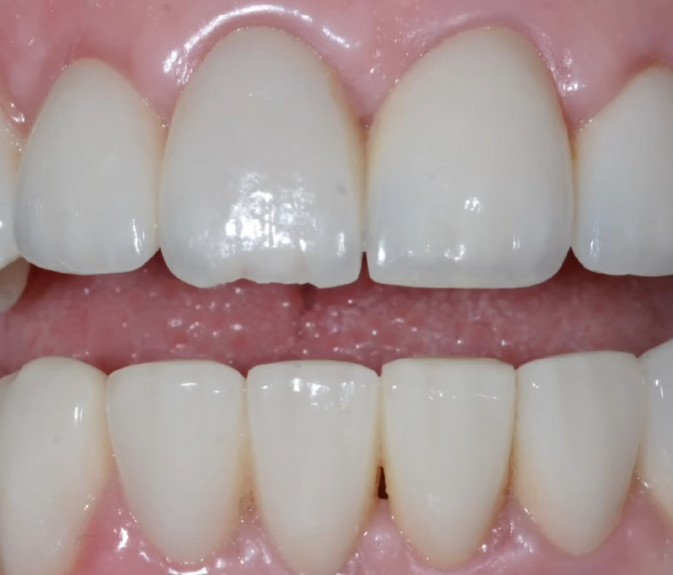 Cosmetic Refinement — before